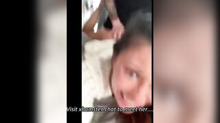 UNEXPECTED ACCIDENTAL ANAL
