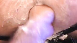 CentralFisting.com - Eric Michaels' massive ass fisting by bobby black