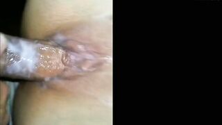 Vagina anal