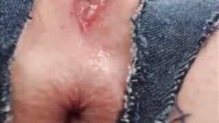 Swollen Clitoris Edge with sex toy