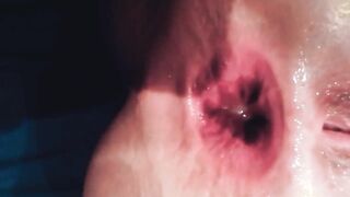 NASTY AMATEUR ANAL GAPE COMPILATION