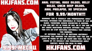 Intense anal fisting, prolapse and huge vibrator - HKJFANS.COM
