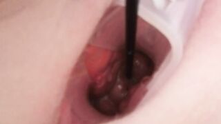 Cervix play
