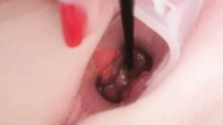 Cervix play