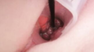 Cervix play