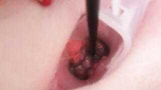 Cervix play