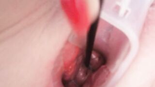 Cervix play