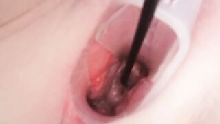Cervix play