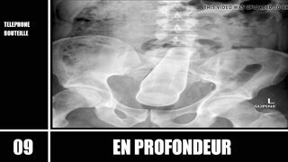 Top 10 - En Profondeur