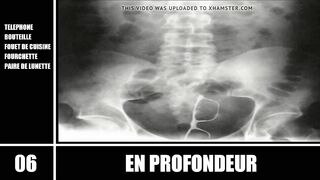 Top 10 - En Profondeur