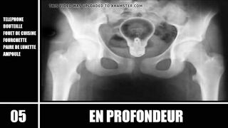 Top 10 - En Profondeur