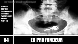 Top 10 - En Profondeur