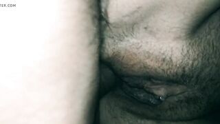Close up painful anal