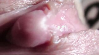 Huge Clitoris