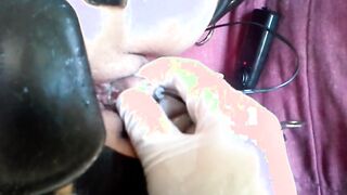 Anal dilation and inspection with orgasms