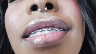 Tattoo Piercing Bdsm Teeth Braces bondage