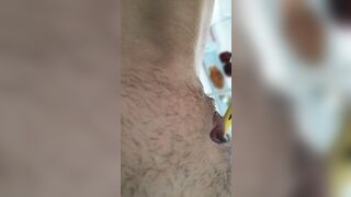 Big clitoris treatment