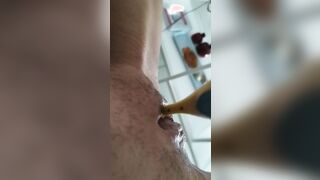 Big clitoris treatment