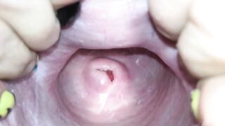 Cervix close up