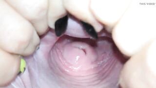 Cervix close up
