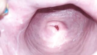 Cervix close up