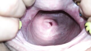 Cervix close up