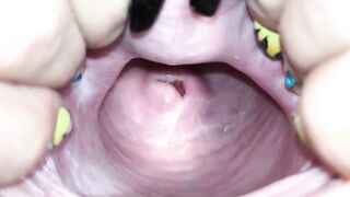Cervix close up