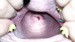 Cervix close up