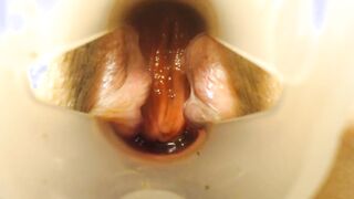 Anal speculum and performance in my asshole