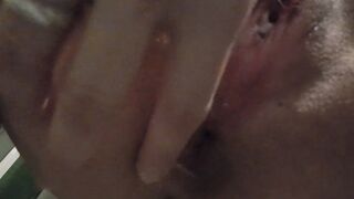 Anal dilation at home