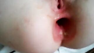 Amazing result of constant anal stretching