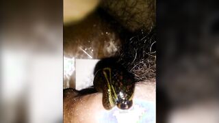 Feeding a leech on the penis