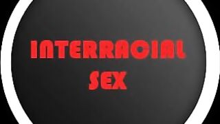 Interracial Sex (Slideshow)