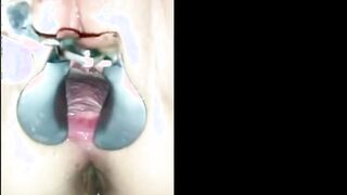 Pig Marina Gets Speculum Creampie