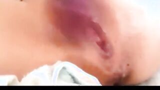 Asian Squirts with Chinese Eggplant