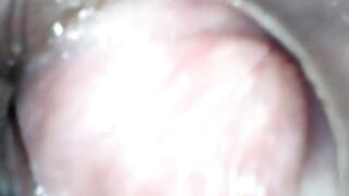 Anal endoscope part two