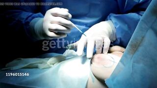 AJ Lee from WWE gets her third breast implant!