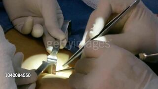 AJ Lee from WWE gets her third breast implant!