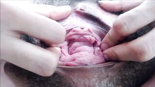 Pervert Files: 18 yo YO Prolapsed Bushy Snatch Meat