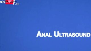 FunSizeBoys Doctor Legrand Wolf and Logan Cross exam room fucking two