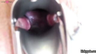 Bizarre amateur BDSM (fisting, speculum)